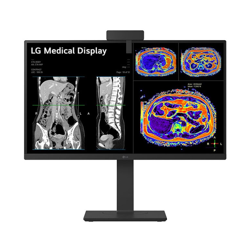 Monitor LG 27hs713c-b.awp 27" Plana 4k/8mp 60HZ LED IPS Dicom/vesa Hdmi/displayport/usb-c/usb - Negro